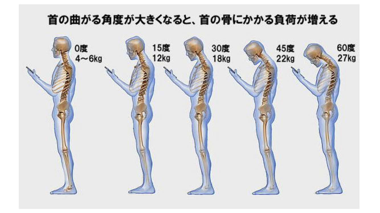 ストレートネック スマホ首って最近良く聞くけど何 こころ鍼灸整骨院 伊丹市の整骨院 産後骨盤矯正 不妊鍼治療 骨格矯正 交通事故むちうち治療